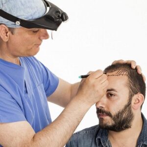 Can you do 5000 grafts in one session?