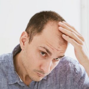 The 12 best ways to stop hair loss in Islamabad