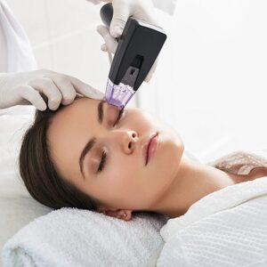 Who should avoid microneedling in Islamabad?