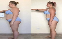 Adipose Lipolysis in Islamabad