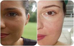 Best Cosmetic Injectables treatment