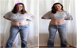 Best Fat Melting Injections in Islamabad