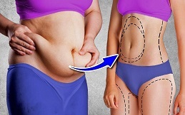 Best Macrolane Injections