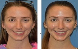 Facial Reconstructive Surgery in Islamabad