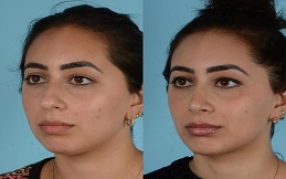 Facial Reconstructive treatment