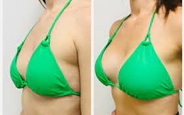 Best Breast Enlargement Injections