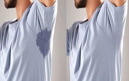 Best botox-for-sweaty-glands