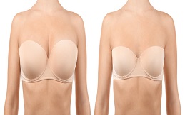 Breast Augmentation cost in Islamabad
