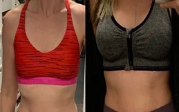 Breast Enlargement Injections cost in Islamabad