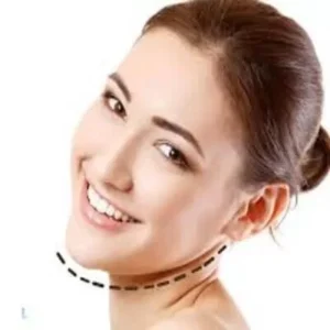 Double Chin Removal Cost in Islamabad