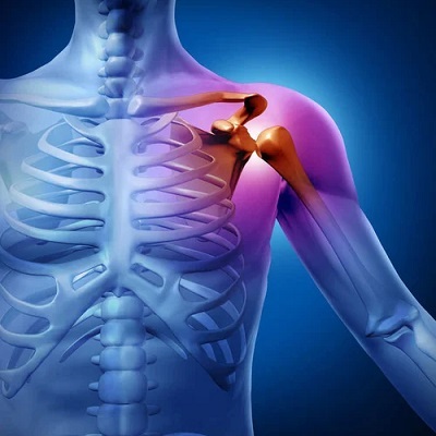 Shoulder Arthroplasty in Islamabad